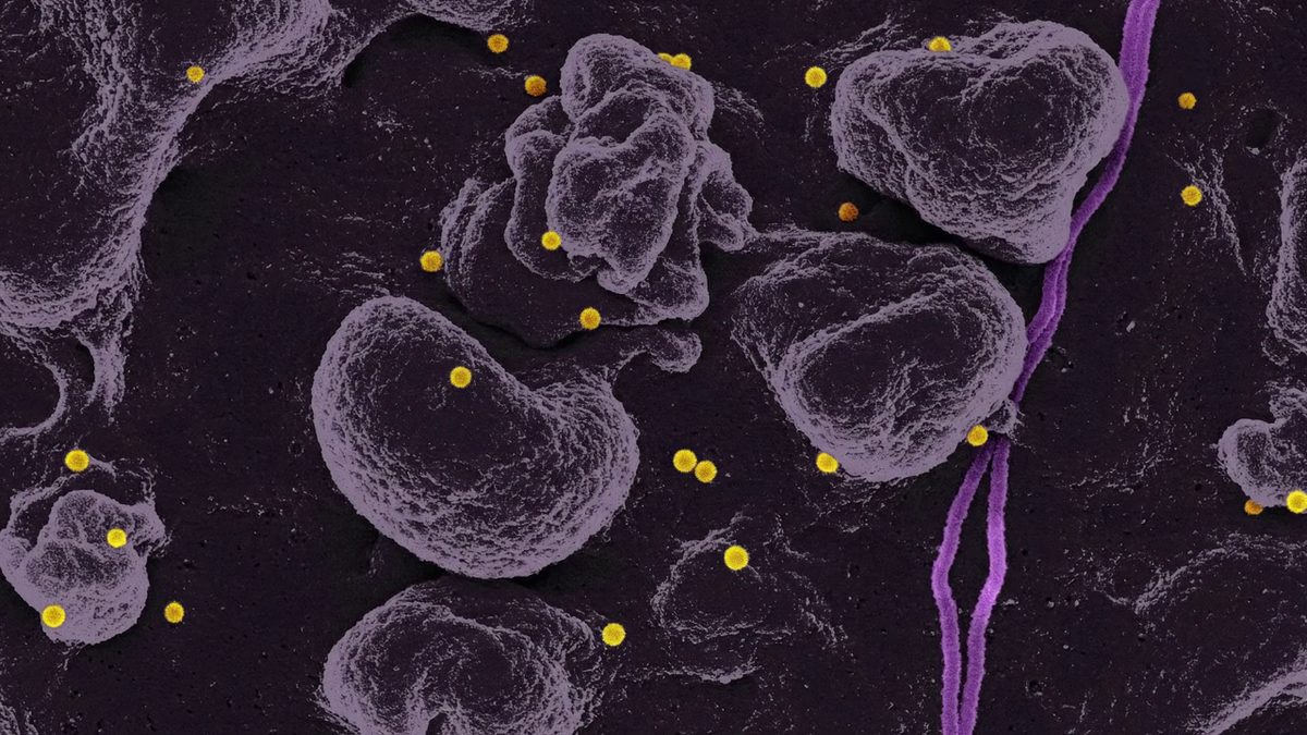 Bovine milk–derived small extracellular vesicles