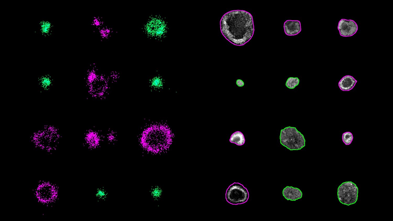 Extracellular vesicle morphology quantification