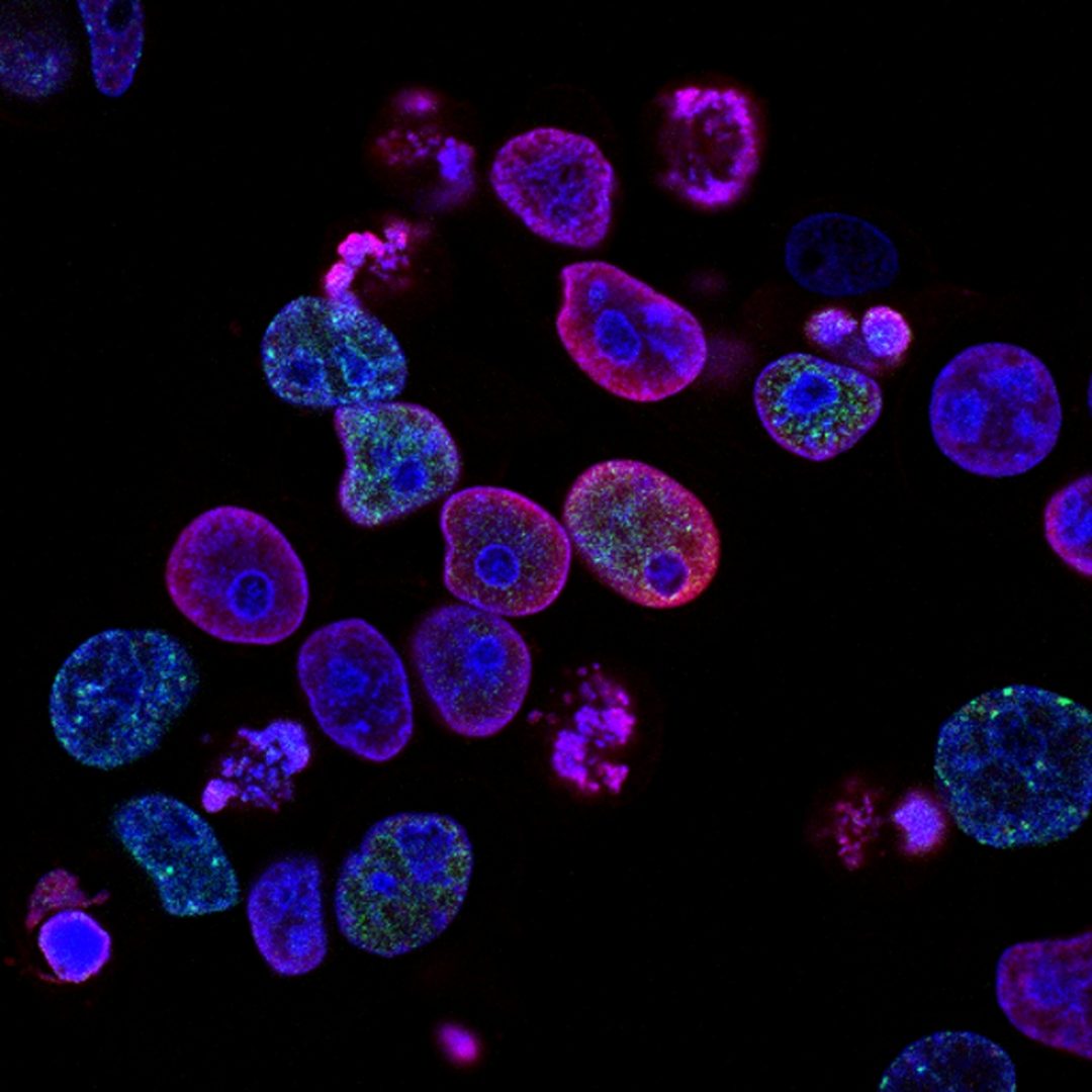 Extracellular vesicle purification from human plasma
